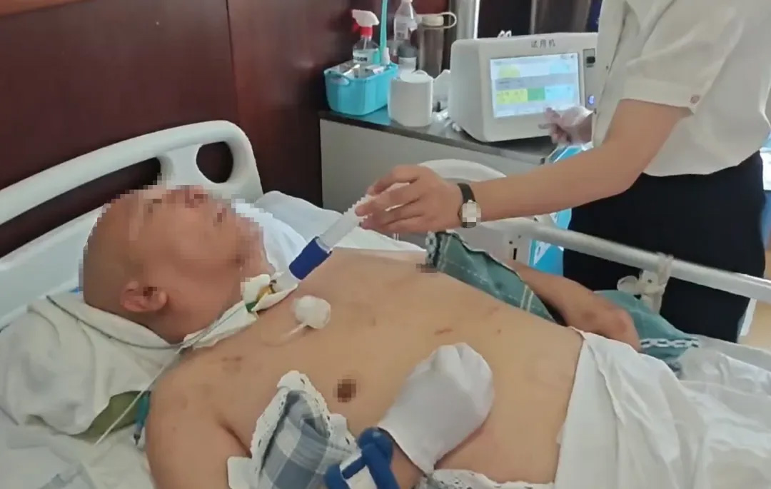 Runkai medical noninvasive expectoration machine